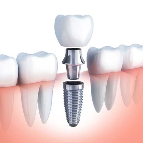 dental orthodontics in devakottai