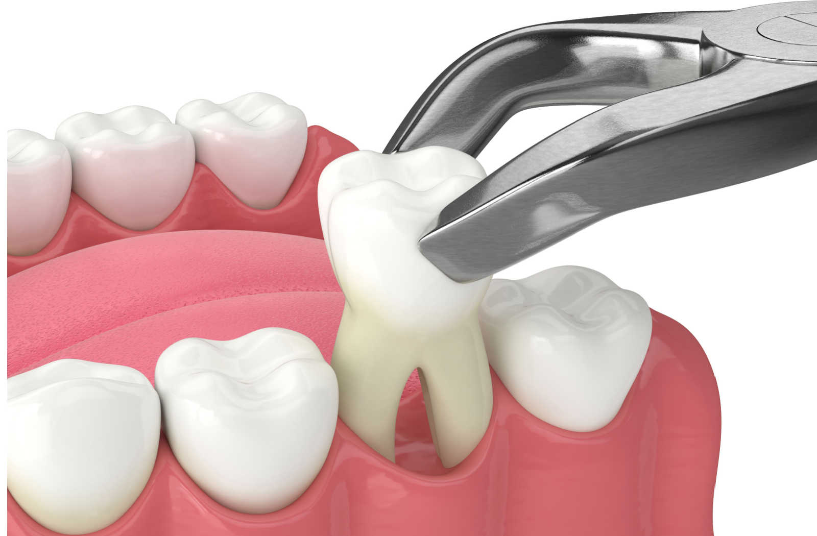 dental orthodontics in devakottai